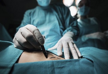 Nữ Việt kiều tử vong sau loạt thủ thuật phẫu thuật thẩm mỹ hút mỡ, nâng ngực