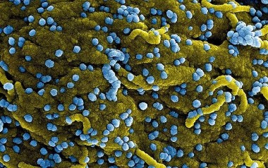 WHO họp khẩn vì virus Marburg gây bệnh sốt xuất huyết ở Trung Phi