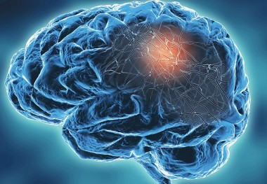 Người mắc COVID-19 nặng não có thể bị già đi 20 tuổi, mất 10 điểm IQ