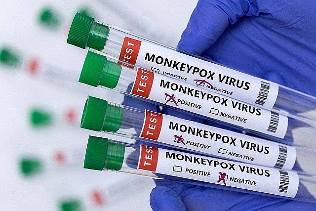 Hàn Quốc và Singapore là 2 quốc gia đầu tiên ở châu Á ghi nhận ca nhiễm đậu mùa khỉ. Ảnh: Reuters