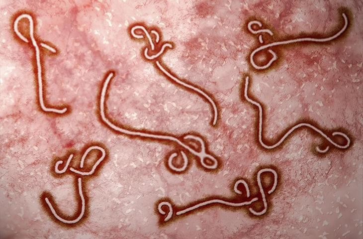 WHO công bố dịch Ebola (sốt xuất huyết Ebola) tại Uganda