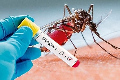 Sốt xuất huyết là bệnh truyền nhiễm cấp tính do virus Dengue gây ra.