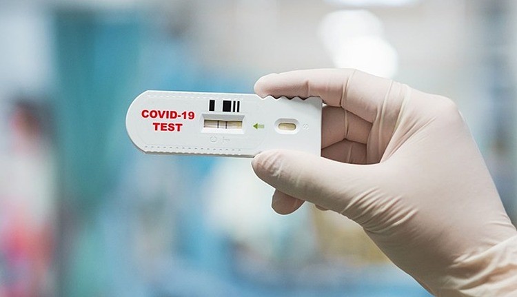 Bộ Y tế lên tiếng về bộ test nhanh Covid-19 mua nước ngoài giá 35 nghìn, trong nước lên 70.000 đồng